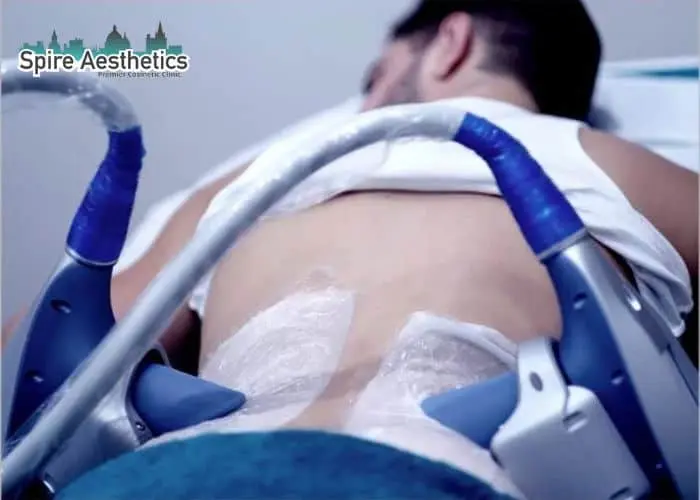 Man having fat freezing treatment done on love handles before a competitions Selly Oak to create a sculpted look.