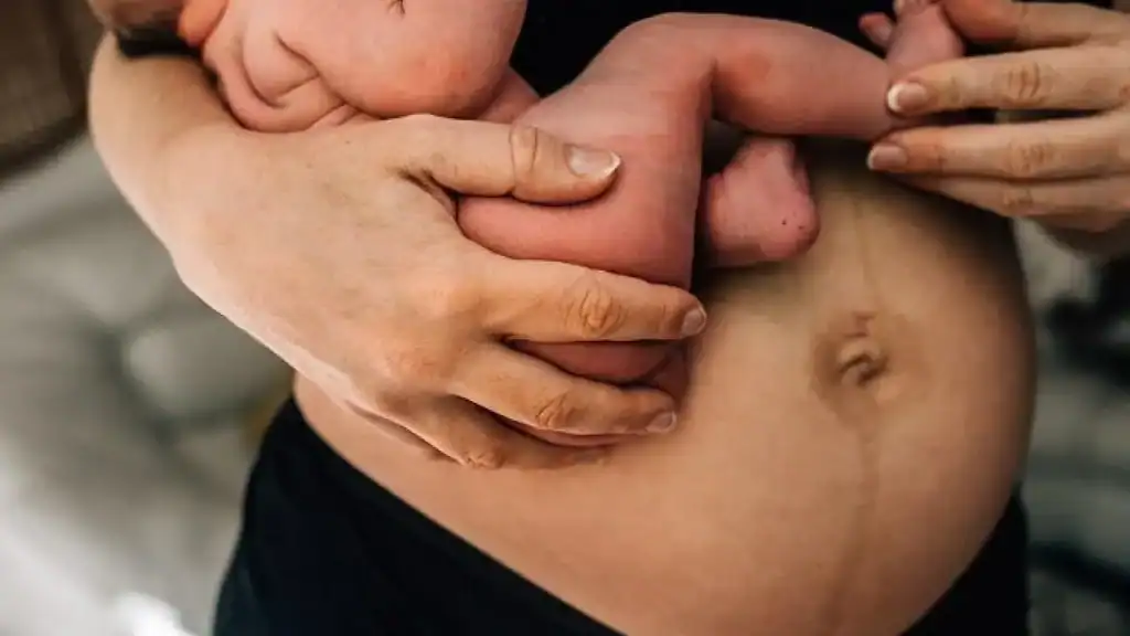 Why Is My Stomach Still Big After Pregnancy Selly Oak?